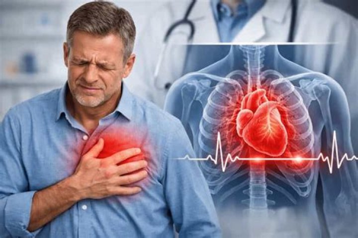 Question: What Does Chest Acquired Mean Lol