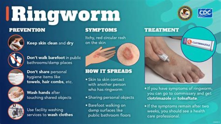 Quick Answer: Can You Get Ringworm From Camping