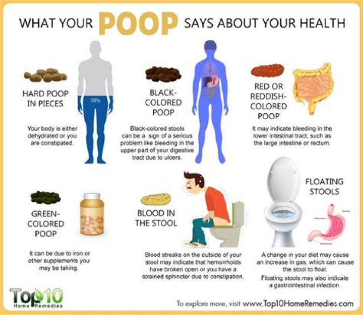 Quick Answer: Why Does Pooping Make Me Feel Sick