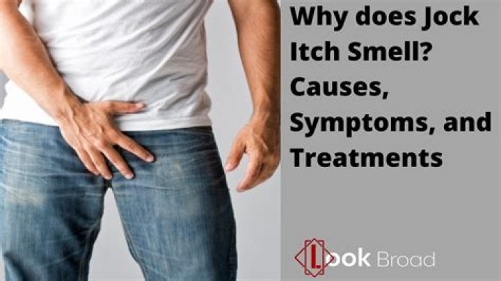 What Does Jock Itch Smell Like