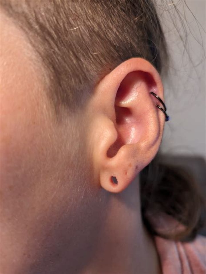 What Is A Gauge Blowout